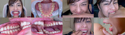【特典動画付】卯水咲流の歯と噛みつきシリーズ1～2まとめてDL
