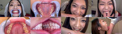 【特典動画付】香苗レノンの歯と噛みつきシリーズ1～2まとめて