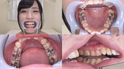 [Tooth fetish] Suzuki Riona-chan&#39;s teeth were observed!