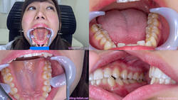 【Tooth fetish】 We observed Aika&#39;s teeth!